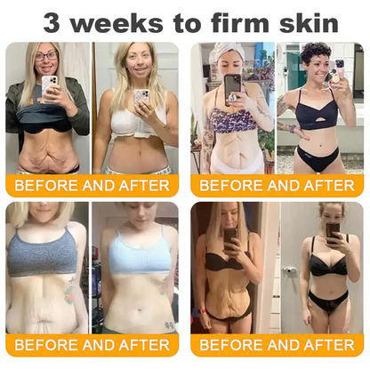 𝐋𝐎𝐕𝐈𝐋𝐃𝐒™ 𝐁𝐞𝐞 𝐕𝐞𝐧𝐨𝐦 𝐀𝐥𝐥-𝐢𝐧-𝐎𝐧𝐞 𝐂𝐫𝐞𝐚𝐦–🌸 🌸Anti-aging,Hydrating, Skin Repair, Even Tone, Acne and Dark Spot Treatment, Wart and Mole Removal, Psoriasis Relief