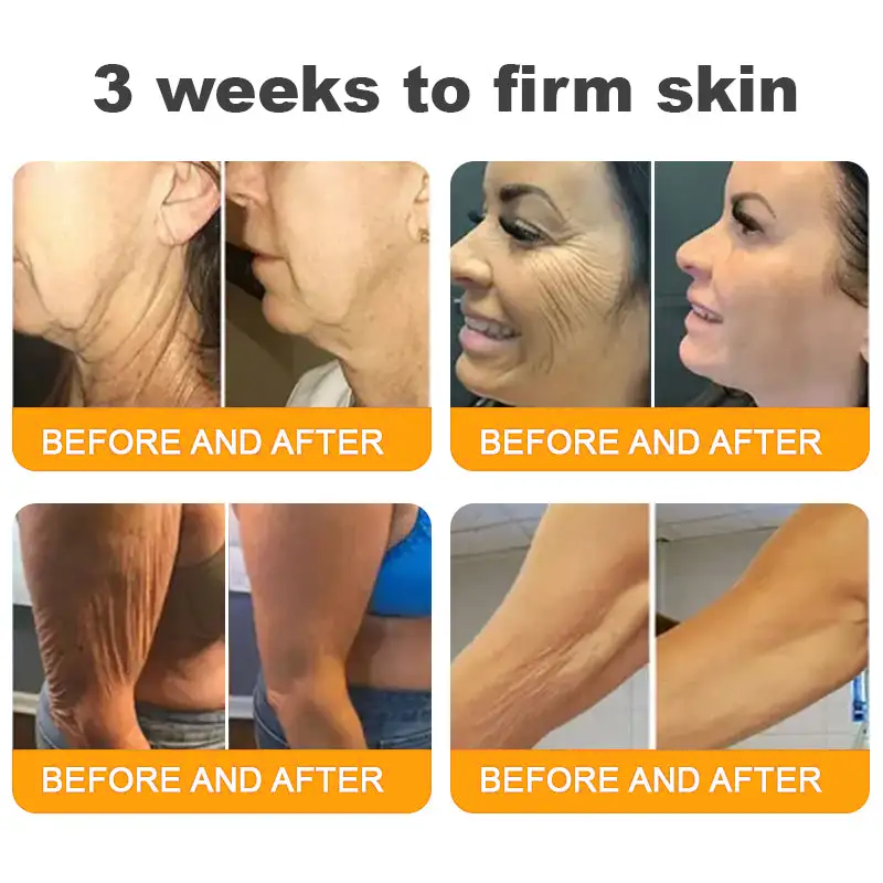 𝐋𝐎𝐕𝐈𝐋𝐃𝐒™ 𝐁𝐞𝐞 𝐕𝐞𝐧𝐨𝐦 𝐀𝐥𝐥-𝐢𝐧-𝐎𝐧𝐞 𝐂𝐫𝐞𝐚𝐦–🌸 🌸Anti-aging,Hydrating, Skin Repair, Even Tone, Acne and Dark Spot Treatment, Wart and Mole Removal, Psoriasis Relief