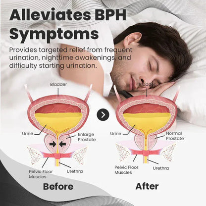 🎅 Early Christmas Sale 🎄 Official Brand Store Last Day Sale: Buy 1 Get 1 Free 🎇 Histone™ CopperMag Prostate Ring 🌟